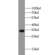 WB analysis of Y79 cells, using OTX2 antibody (1/500 dilution).