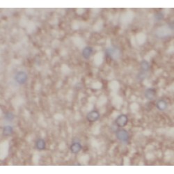 Mitochondrial Inner Membrane Protein OXA1L (OXA1L) Antibody