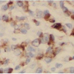 p115, USO1 Antibody