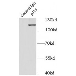 p115, USO1 Antibody