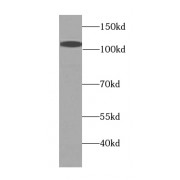 WB analysis of HepG2 cells, using p115, USO1 antibody (1/1500 dilution).