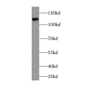 WB analysis of A431 cells, using BCAR1 antibody (1/800 dilution).