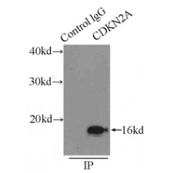 P16-INK4A Antibody