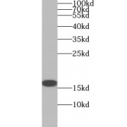 WB analysis of HEK-293 cells, using P16 antibody (1/1000 dilution).