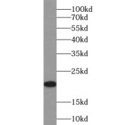 WB analysis of HEK-293 cells, using P21 antibody (1/500 dilution).