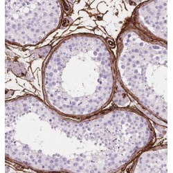 P2Y Purinoceptor 1 (P2RY1) Antibody