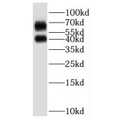 WB analysis of Jurkat cells, using P2RY1 antibody (1/500 dilution).