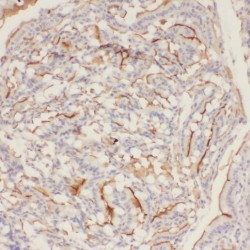 P2Y Purinoceptor 12 (P2RY13) Antibody