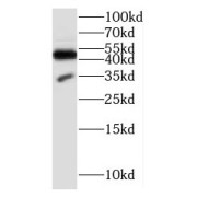 WB analysis of untreated and Staurosporine-treated Jurkat cells, using p35 antibody (1/5000 dilution).