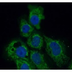 Prolyl 4-Hydroxylase Subunit Alpha-1 (P4HA1) Antibody