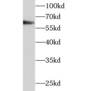 WB analysis of A431 cells, using P4HA1 antibody (1/600 dilution).