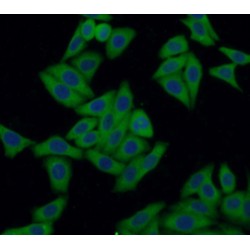 Cellular Tumor Antigen P53 (P53) Antibody