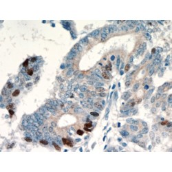 Cellular Tumor Antigen P53 (P53) Antibody