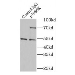 p70S6K Antibody