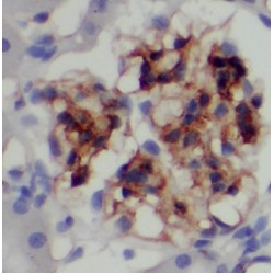 Proteasomal ATPase-Associated Factor 1 (PAAF1) Antibody