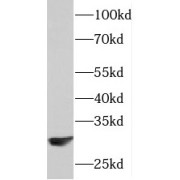 WB analysis of mouse brain tissue, using PAAF1 antibody (1/2000 dilution).