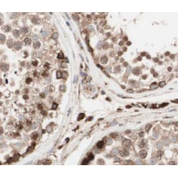 PABPC1,PABP Antibody