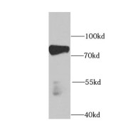 WB analysis of mouse heart tissue, using PABPC4 antibody (1/1000 dilution).