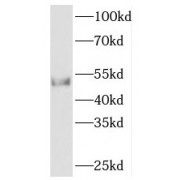 WB analysis of mouse cerebellum tissue, using PACSIN1 antibody (1/1000 dilution).