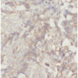 Protein Kinase C And Casein Kinase Substrate In Neurons Protein 2 (PACSIN2) Antibody