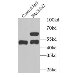 Protein Kinase C And Casein Kinase Substrate In Neurons Protein 2 (PACSIN2) Antibody