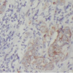 Protein Kinase C And Casein Kinase Substrate In Neurons Protein 3 (PACSIN3) Antibody