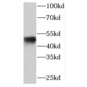 WB analysis of HeLa cells, using PACSIN3 antibody (1/1000 dilution).