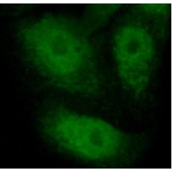 Peptidyl Arginine Deiminase Type IV (PADI4) Antibody