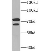 WB analysis of BT474 cells, using PADI4 antibody (1/600 dilution).