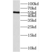 WB analysis of mouse brain tissue, using PAG1 antibody (1/1000 dilution).