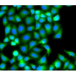 P21 Protein Activated Kinase 2 (PAK2) Antibody