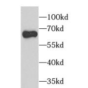 WB analysis of human skeletal muscle tissue, using PAK2 antibody (1/1000 dilution).