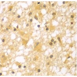 P21 Activated Kinase 6 (PAK6) Antibody