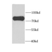 WB analysis of PC-3 cells, using PAK6 antibody (1/1000 dilution).