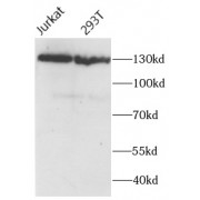 WB analysis of various lysates, using PALB2 antibody (1/500 dilution).