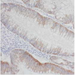 Palladin (PALLD) Antibody