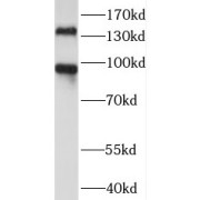 WB analysis of A549 cells (shControl and shRNA of PALLD), using Palladin antibody (1/2000. dilution).