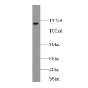 WB analysis of HeLa cells, using Palladin-Specific antibody (1/200 dilution).