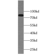 WB analysis of mouse skeletal muscle tissue, using PAMR1 antibody (1/500 dilution).