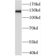 WB analysis of NIH/3T3 cells, using PAN2 antibody (1/300 dilution).