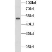 WB analysis of human brain tissue, using PANX1 antibody (1/500 dilution).