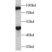 WB analysis of mouse liver tissue, using PAPD5 antibody (1/1000 dilution).