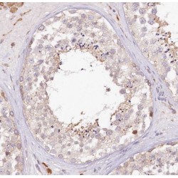 Poly(A) Polymerase Gamma (PAPOLG) Antibody