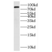 WB analysis of HeLa cells, using PAPOLG antibody (1/1000 dilution).