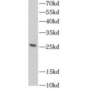 WB analysis of HeLa cells, using PAQR4 antibody (1/600 dilution).