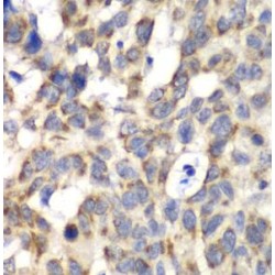 Poly A Specific Ribonuclease (PARN) Antibody