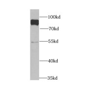 WB analysis of MDA-MB-453s cells, using PARN antibody (1/1000 dilution).