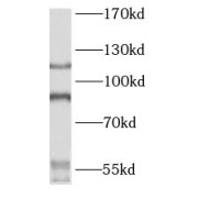 WB analysis of Jurkat cells, using PARP1 antibody (1/1000 dilution).