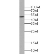 WB analysis of A431 cells, using PARP15 antibody (1/500 dilution).