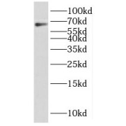 WB analysis of HeLa cells, using PARP2 antibody (1/2000 dilution).